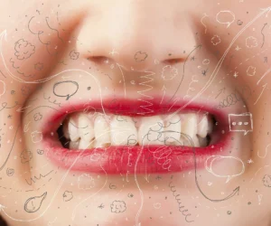 Actualité traitement du bruxisme botox